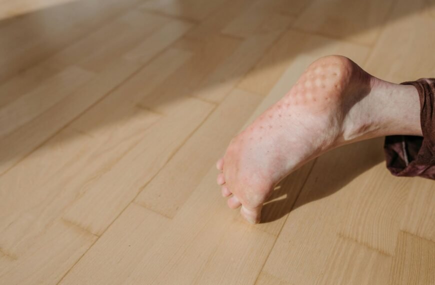 Understanding Bunions Treatment Options in Houston for Long-Term Foot&hellip;